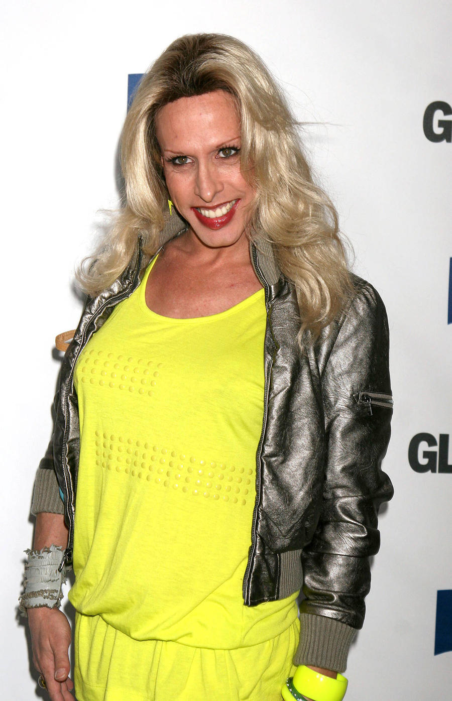 Actress And Activist Alexis Arquette Dead At 47 